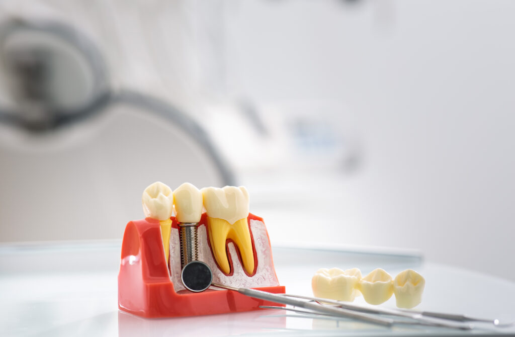Stomatology concept. Detailed tooth model showcases the layers of enamel and dentin in a bright dental office equipped for patient care