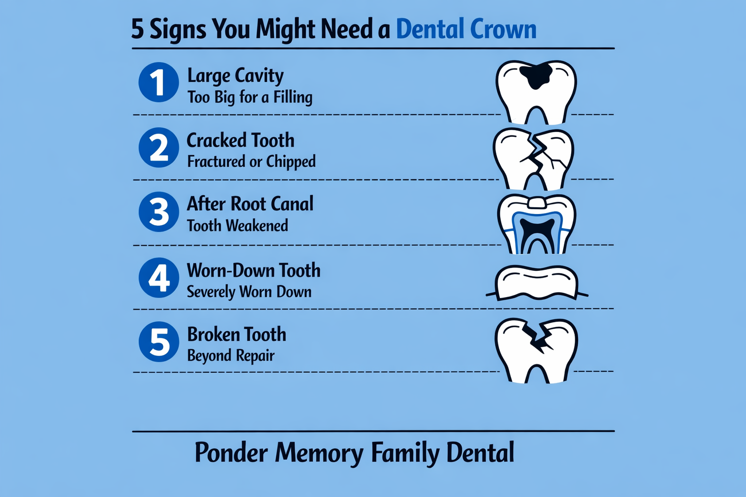 Signs You Need a Crown